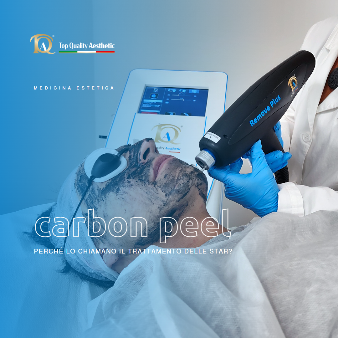 Carbon Peel